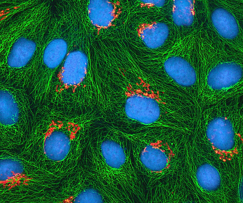 Real cultured human HeLa cells imaged by multiphoton fluorescence microscopy. DNA is cyan, microtubules green and the Golgi apparatus orange.